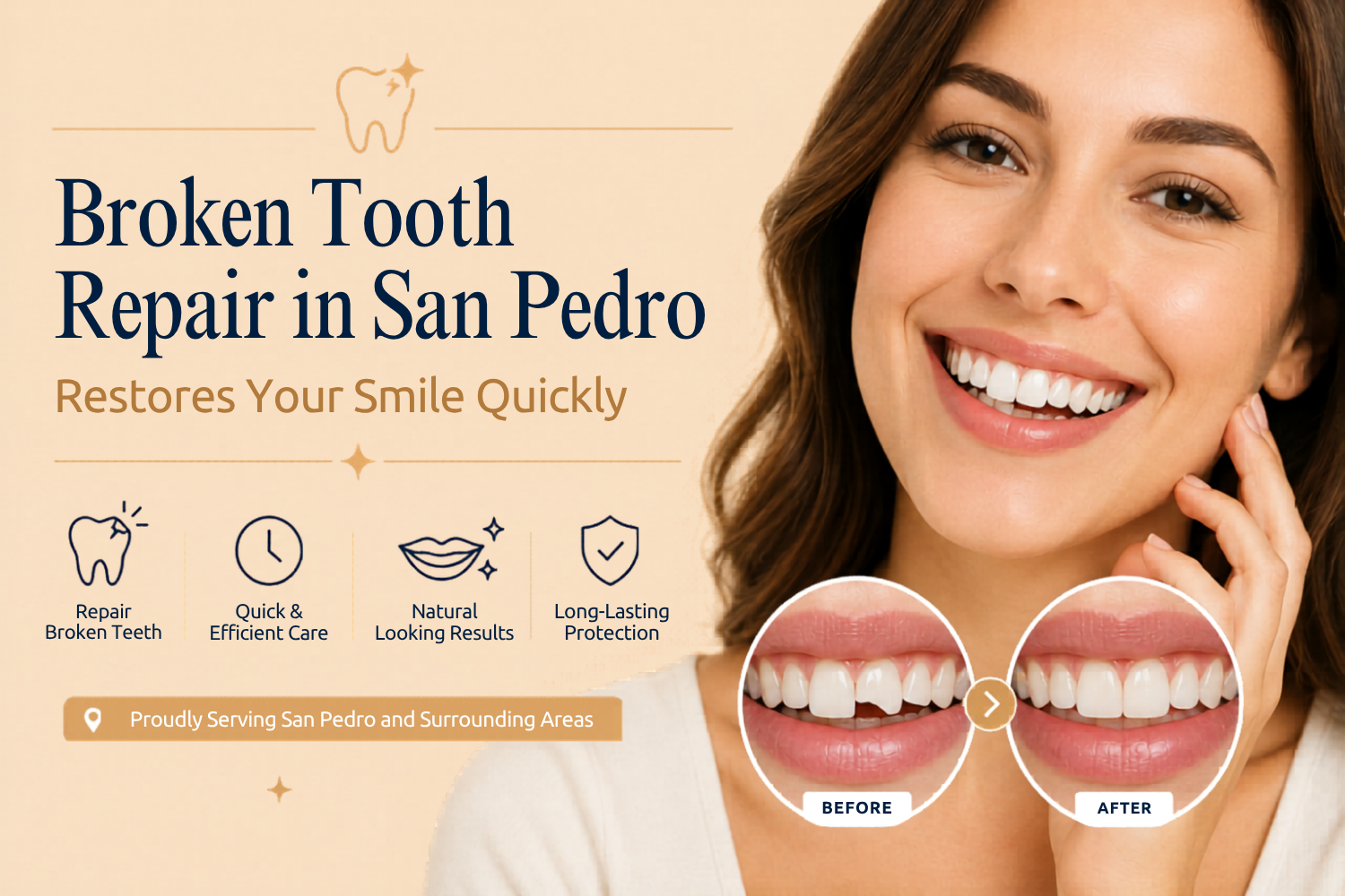 How Broken Tooth Repair in San Pedro Restores Your Smile Quickly