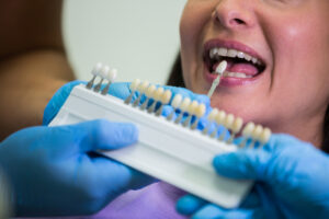How Dental Veneers in Lomita Can Transform Your Teeth
