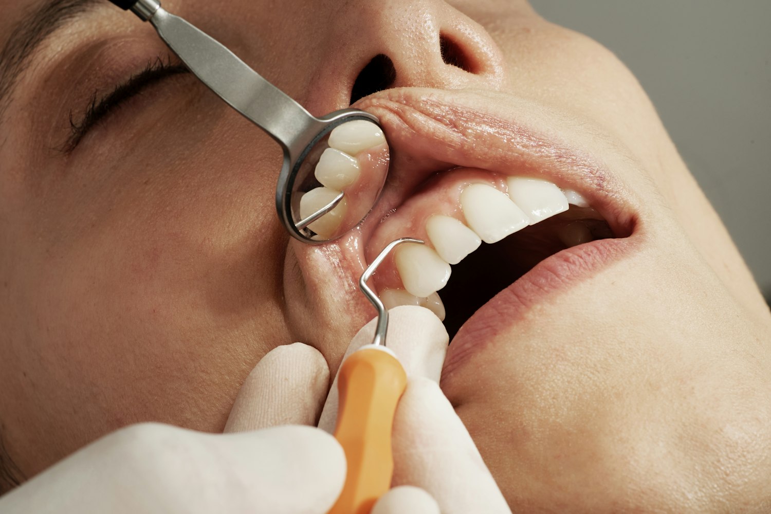 Lost Your Dental Coverage? What to Do When You Don’t Have Dental Insurance
